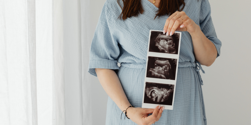 pregnant woman holding ultrasound photo of rainbow baby